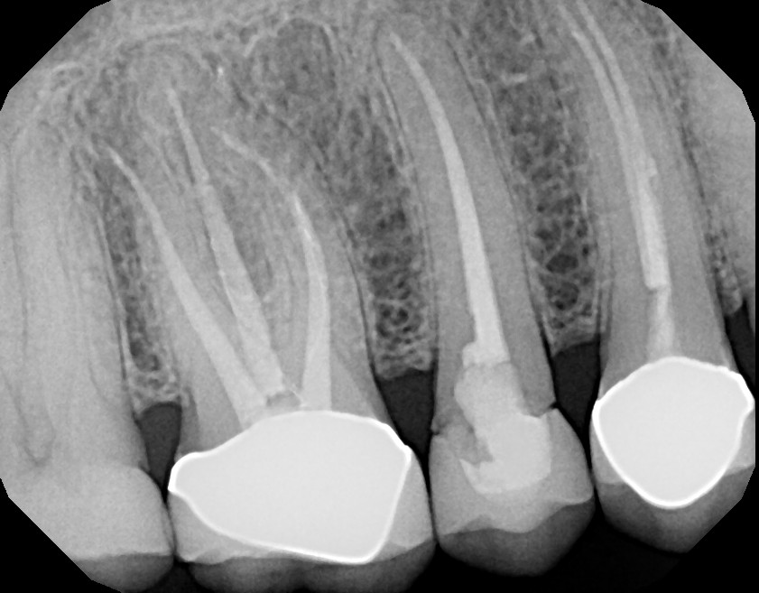 cerec dental cerec dental